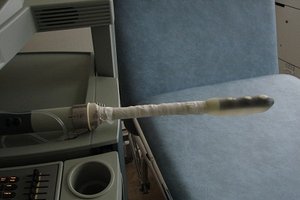 Photo of the ultrasound machine
